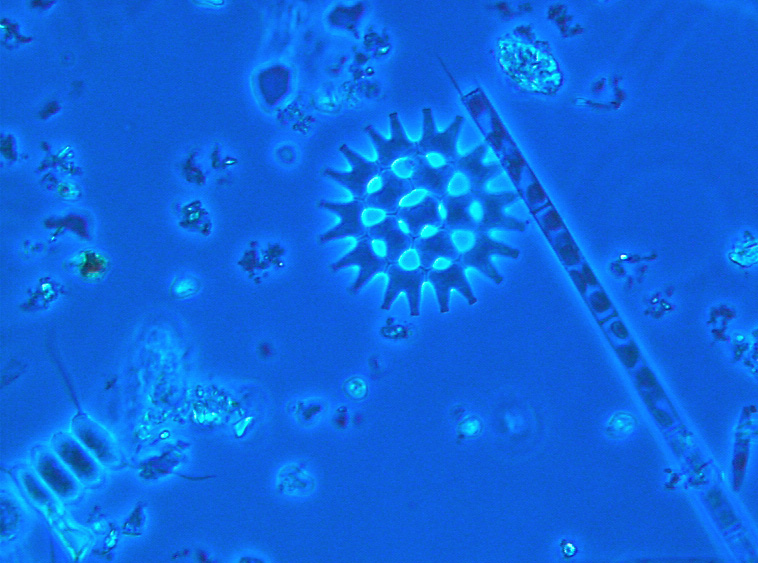 Verschiedene Grünalgenarten als Vertreter des Phytoplanktons unter einem Lichtmikroskop. Im Zentrum des Bildes befindet sich eine kugelförmige, stachel bewehrte Kolonie der Gattung Pediastrum. Daneben, in Richtung der unteren rechten Ecke weisend, ist eine fadenförmige Kolonie zu sehen. In der linken unteren Ecke ist eine aus vier Einzelzellen bestehende Kolonie der Gattung Scenedesmus erkennbar. Dazwischen sind einige Bruchstücke, Kristalle und Verunreinigungen sichtbar.